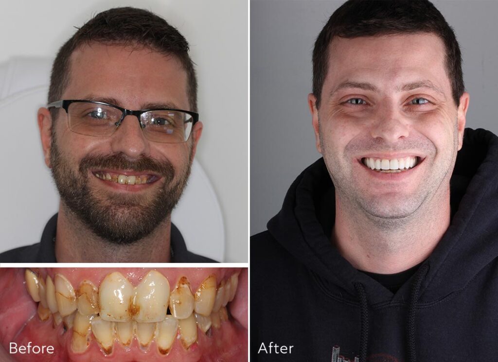 View Our Smile Gallery 412 Dental Monroeville, PA